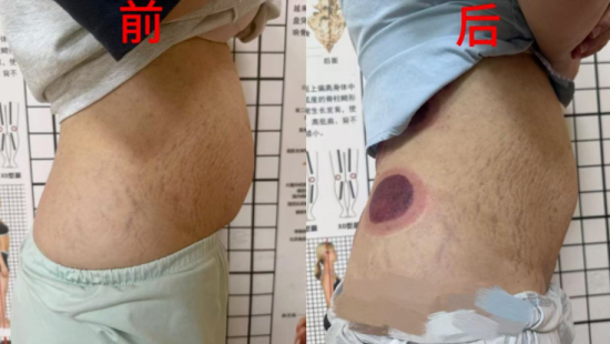 10次治疗后 10次治疗后